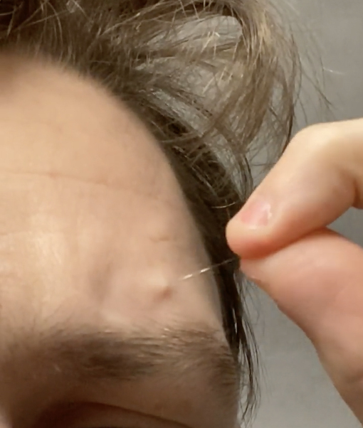 a person pulling a long gray hair out of their forehead