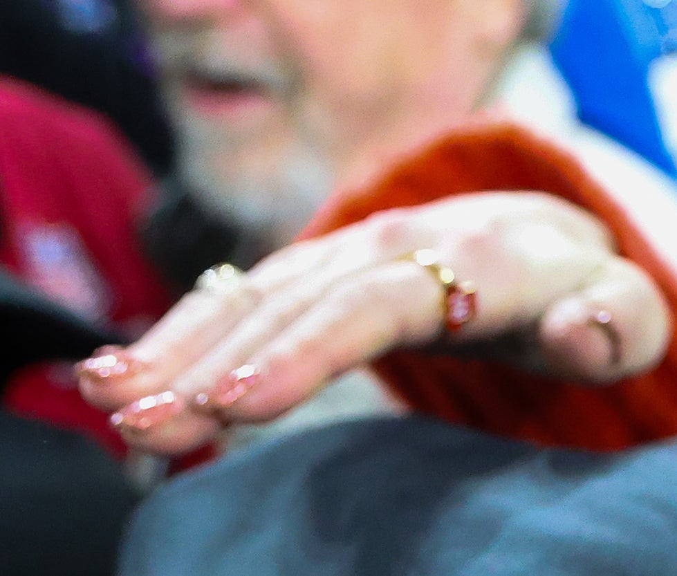 Closeup of Taylor&#x27;s hand