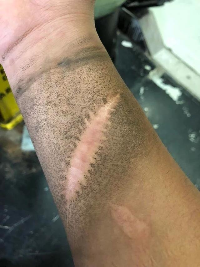 A dirty forearm with a clean line amid the dirt