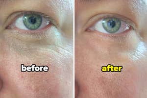 before/after of reviewer who used an eye cream showing soft, smoother skin