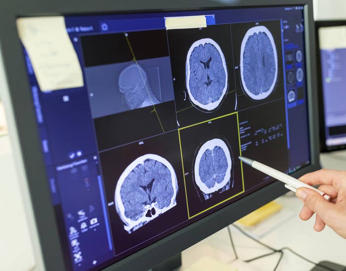 Health professional analyzes brain scan images on a computer monitor