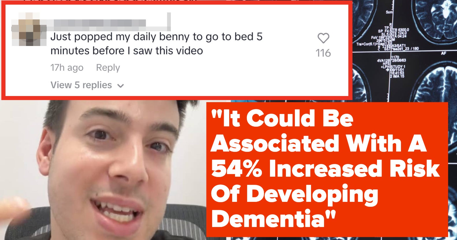 Doctor Warns: Benadryl Linked To Dementia Risk - 2025 Benadryl Is A Common Over