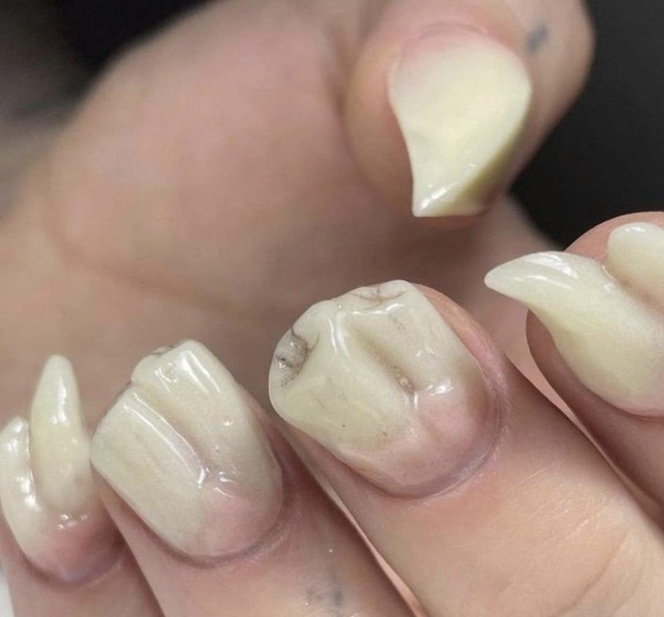 nails looks like teeth