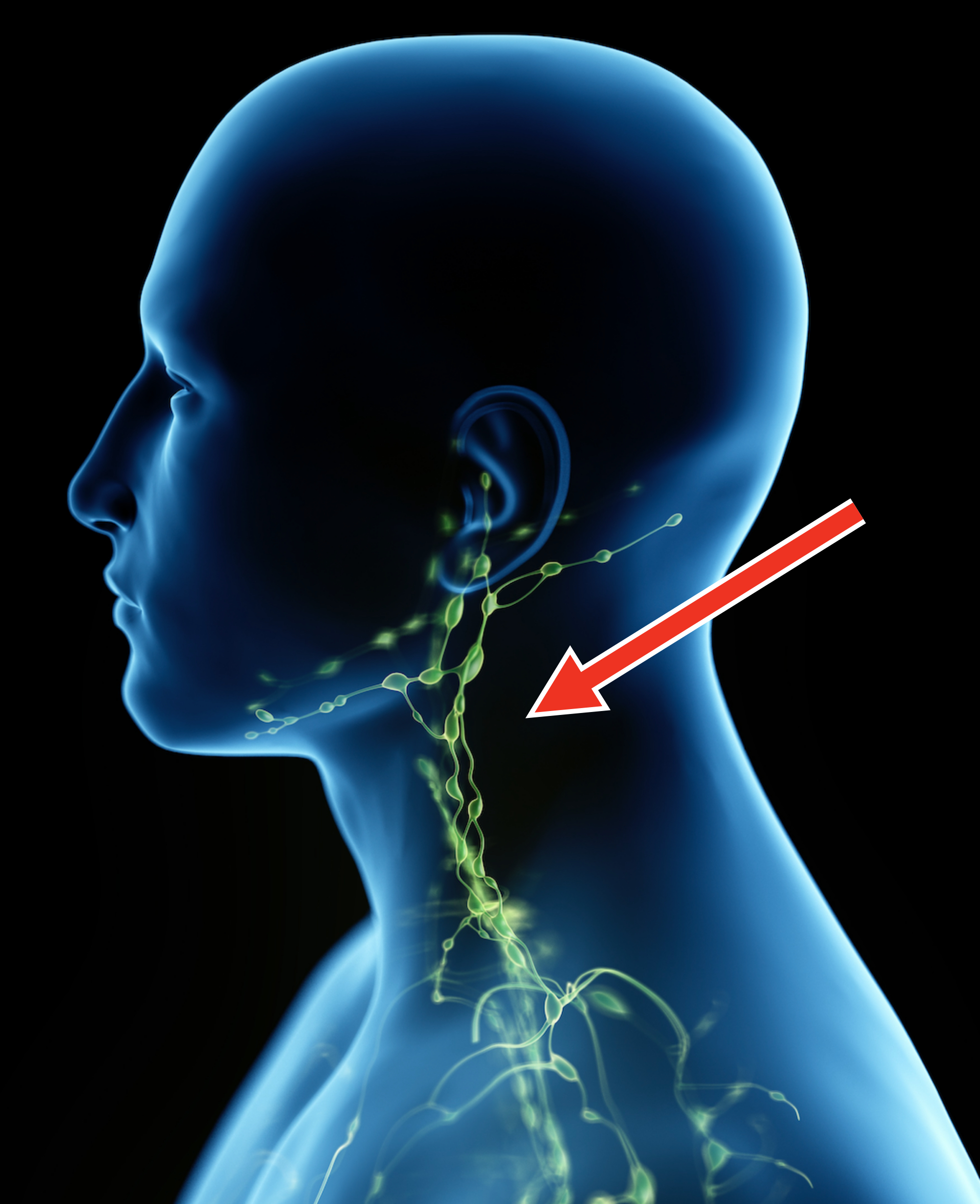 A digital illustration of a human&#x27;s lymphatic system from the neck up, highlighting nodes and pathways
