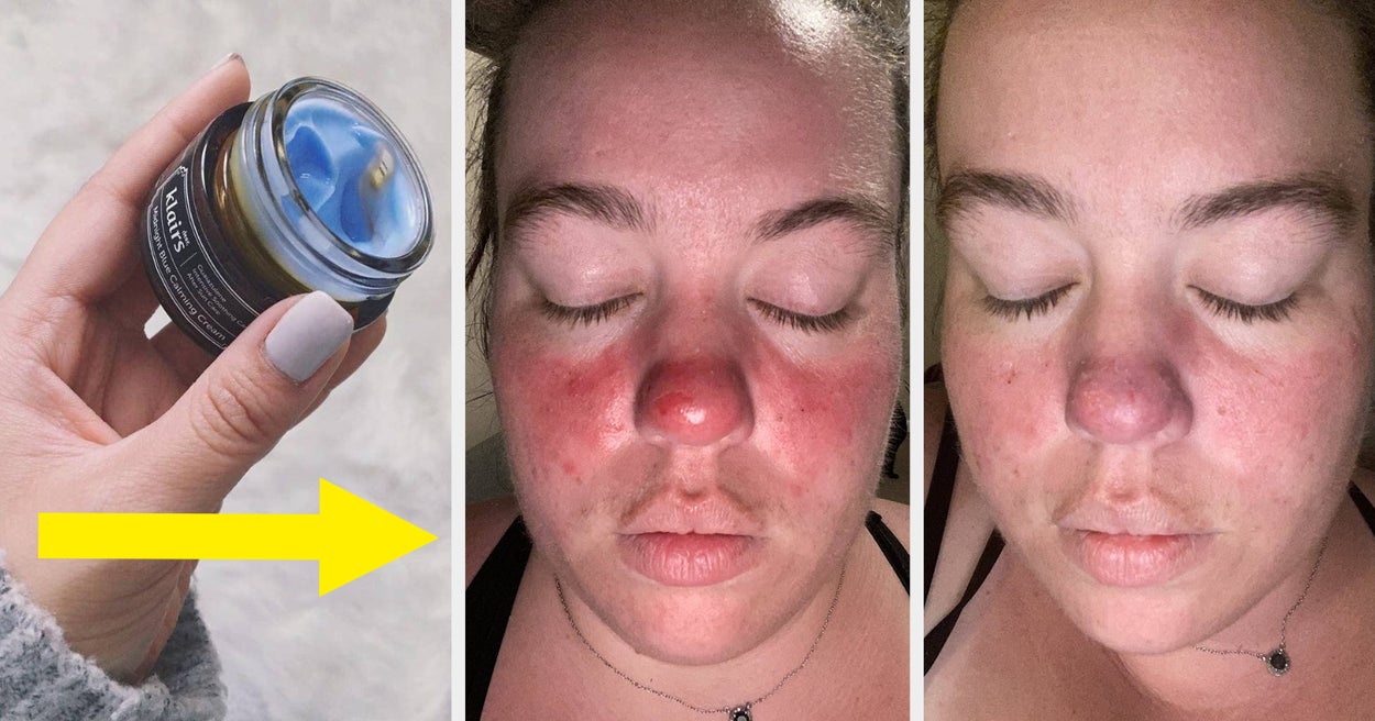 31 Skincare Products With Wow-Worthy Reviewer Pics