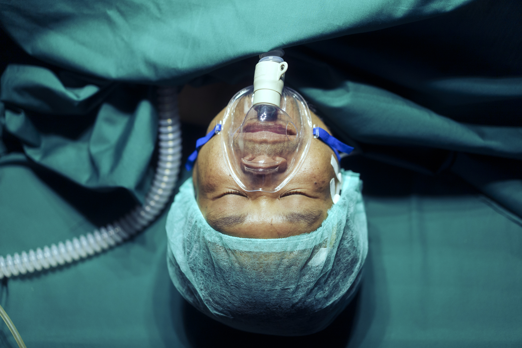 Patient in surgery with an oxygen mask and surgical drape