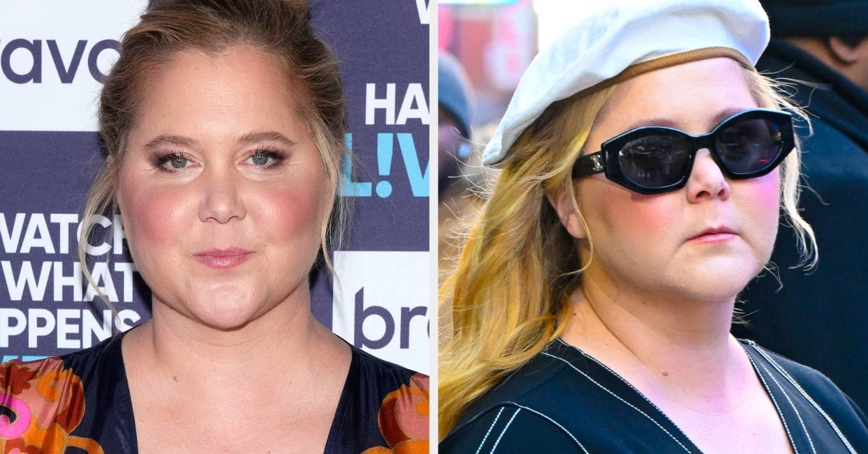 Amy Schumer Diagnosed With Cushing Syndrome