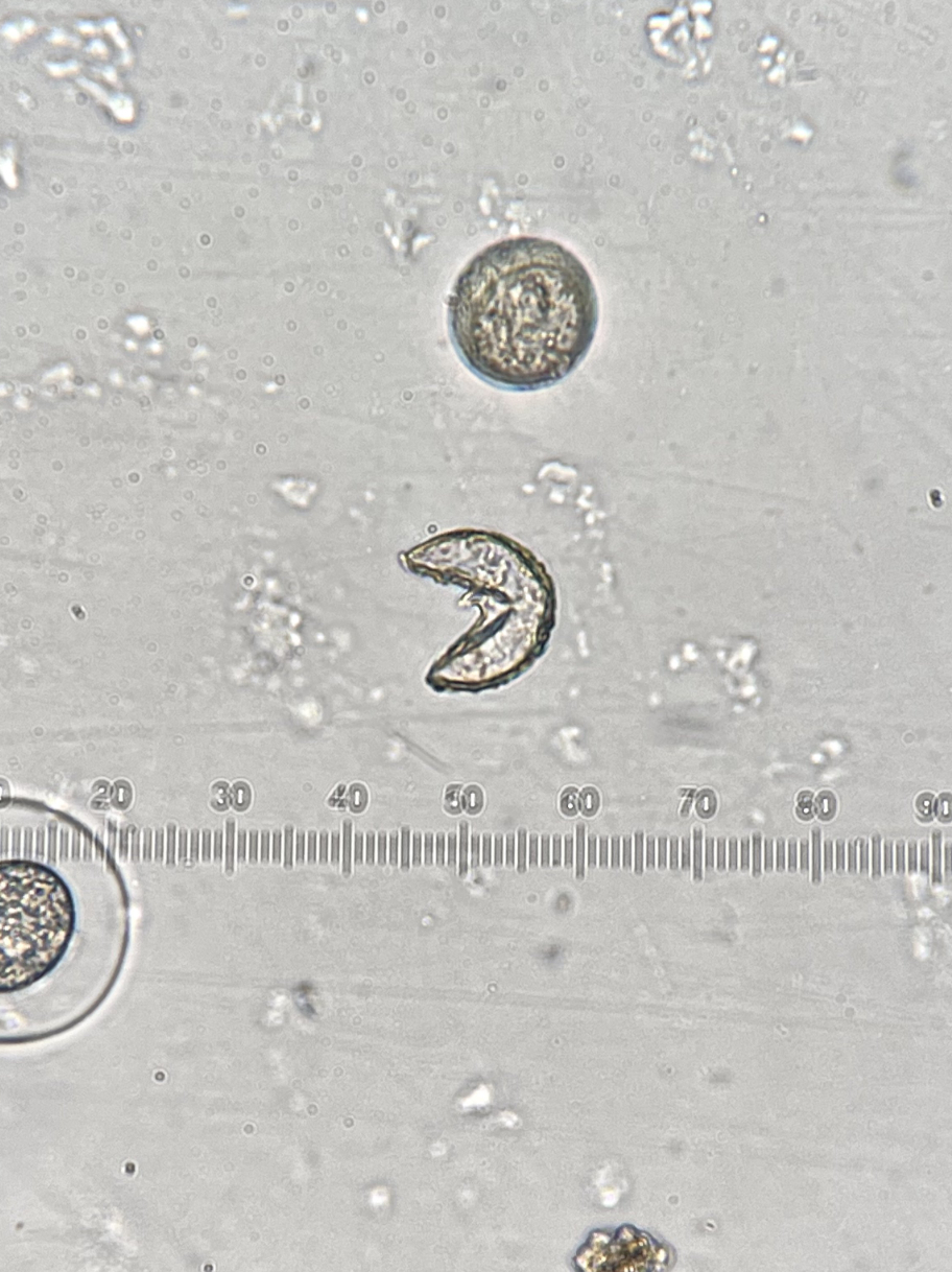 顕微鏡で見た線虫とその他の標本。目盛りはミクロン単位。