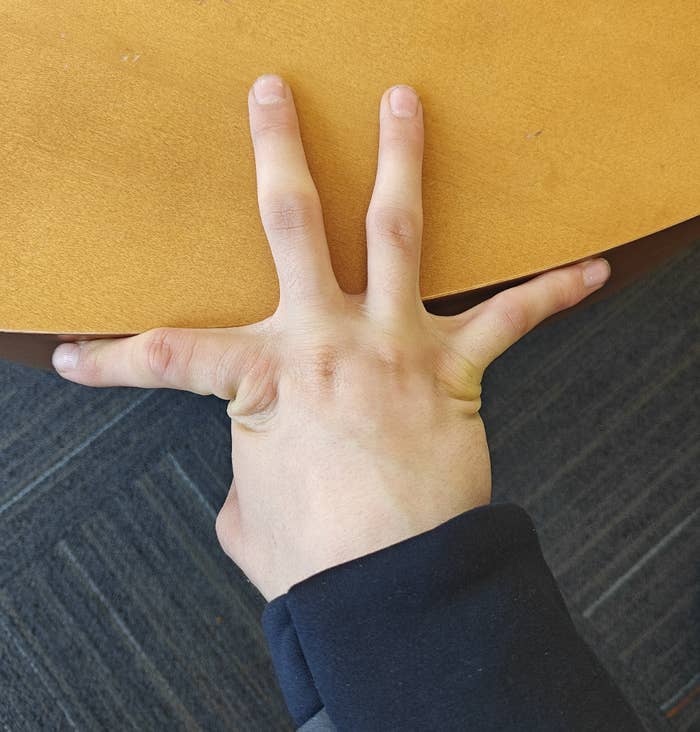 Person&#x27;s fingers stretched in opposite directions