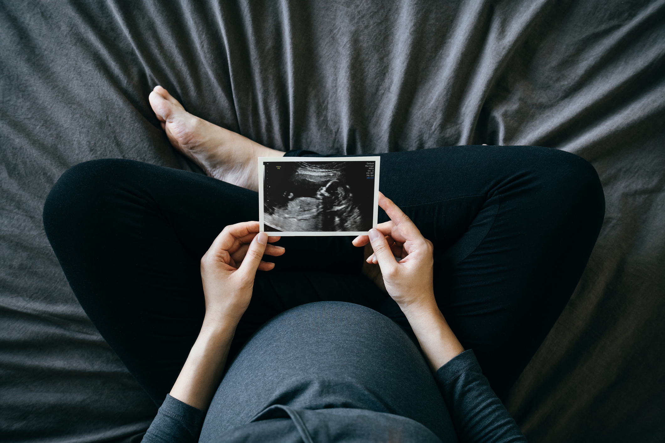 Person sitting with ultrasound photo in hands, legs forming a triangle shape on a bed