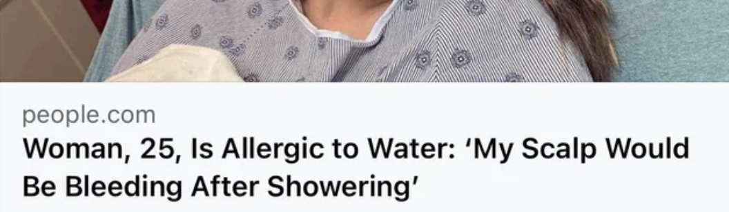 Article headline about a 25-year-old woman who is allergic to water, discussing her experience with scalp bleeding after showers