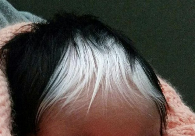 baby with white patch of hair