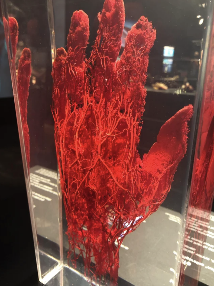3D exhibit of red blood vessels shaped like a hand inside a clear block