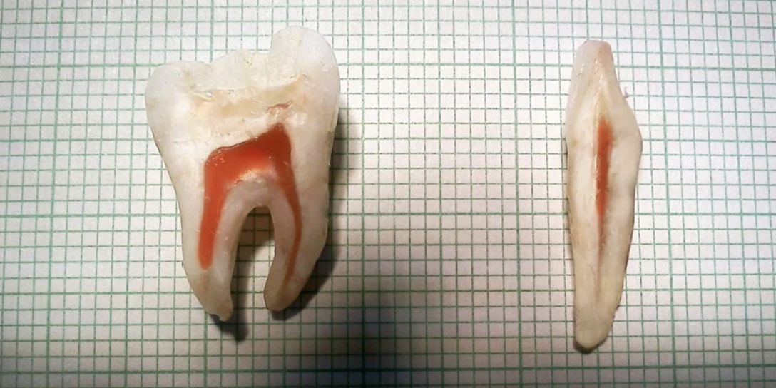 teeth cut in half