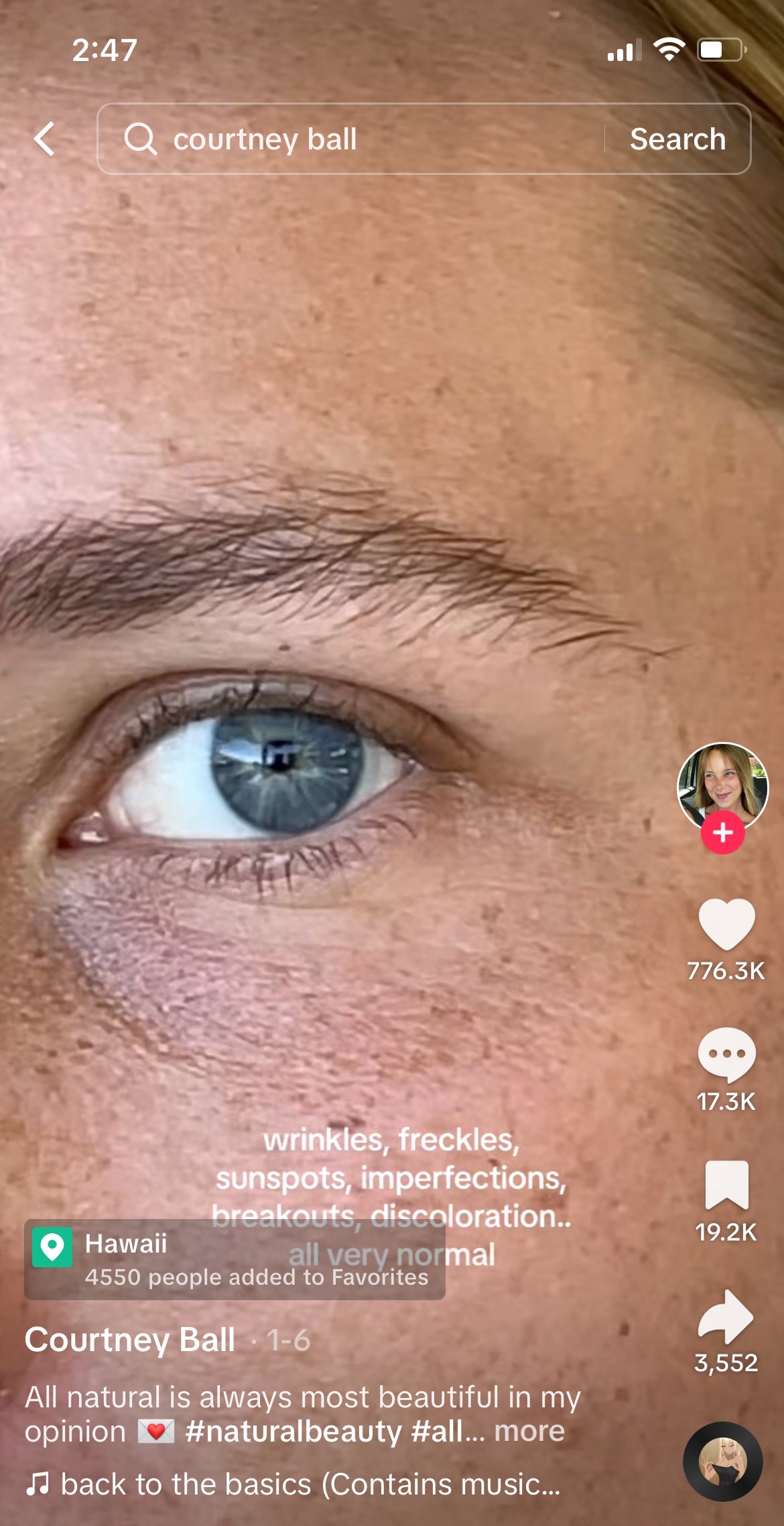 Close-up showing fine lines and freckles around Courtney&#x27;s eye