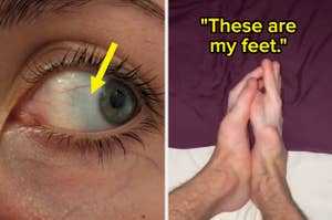 an eye with a dark ring, and feet with toes that look like fingers