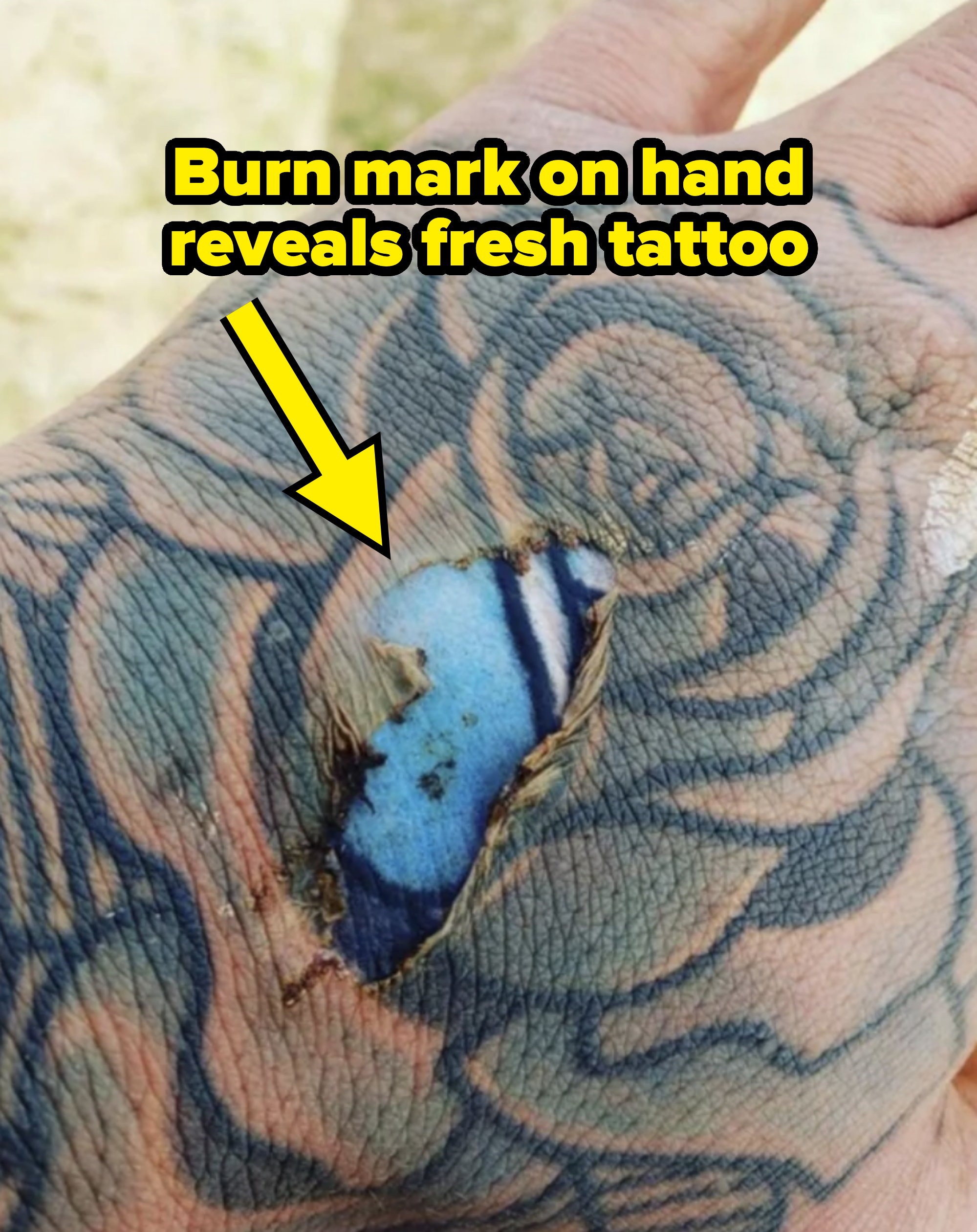 faded tattoo with burn mark with brighter version of tattoo under it
