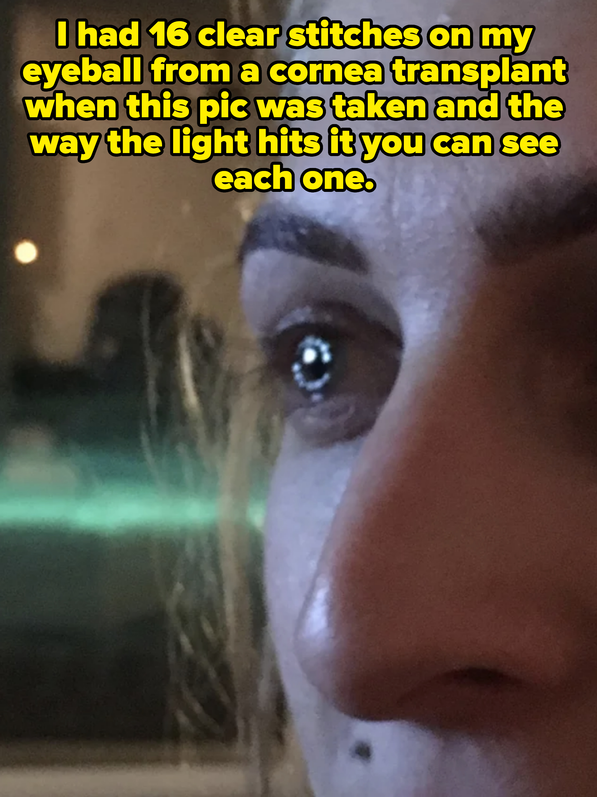 Close-up of a person&#x27;s eye and part of their nose, with a reflection of light visible in the eye