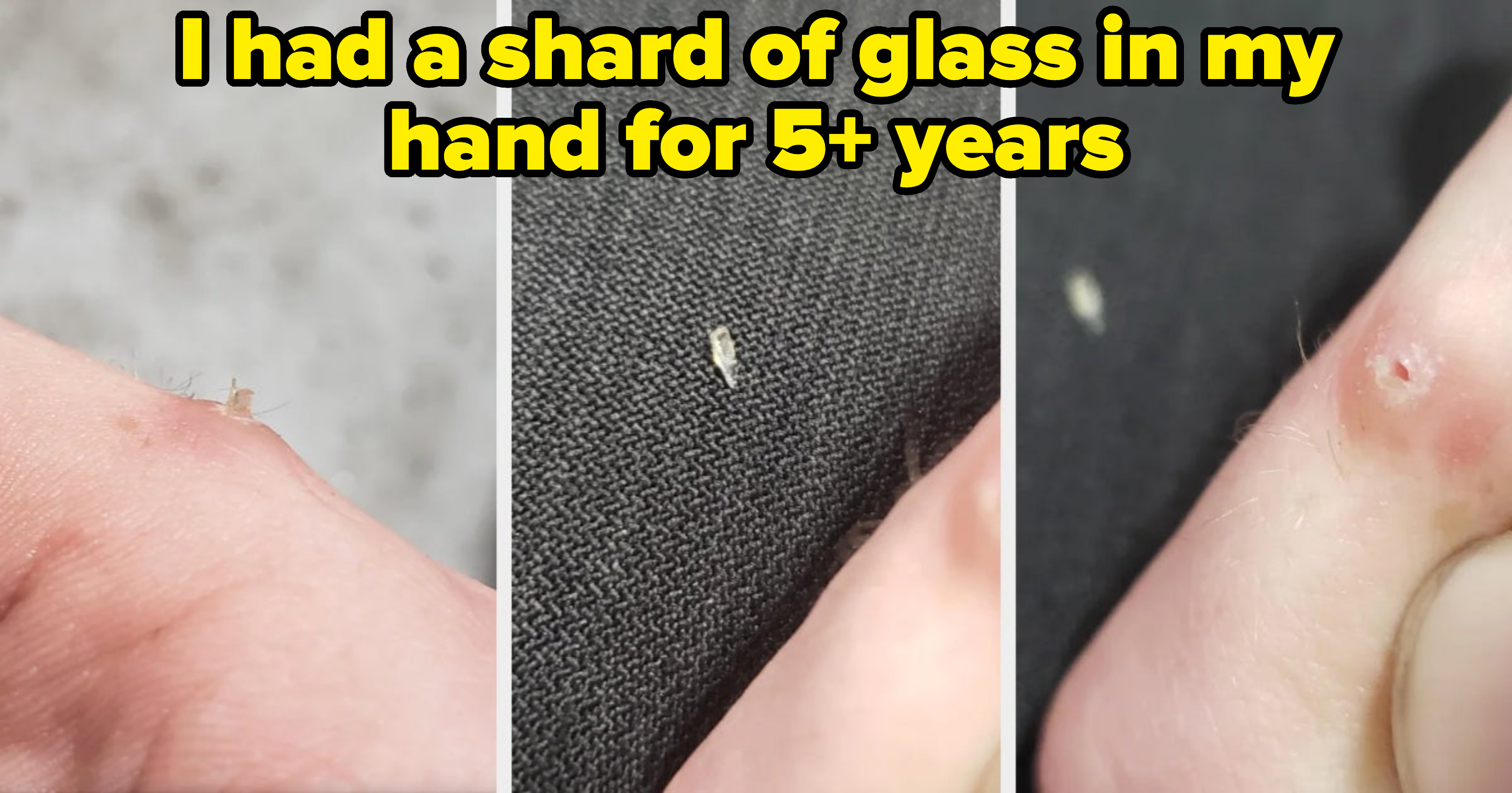 tiny shard of glass in someone&#x27;s hand then on fabric behind it