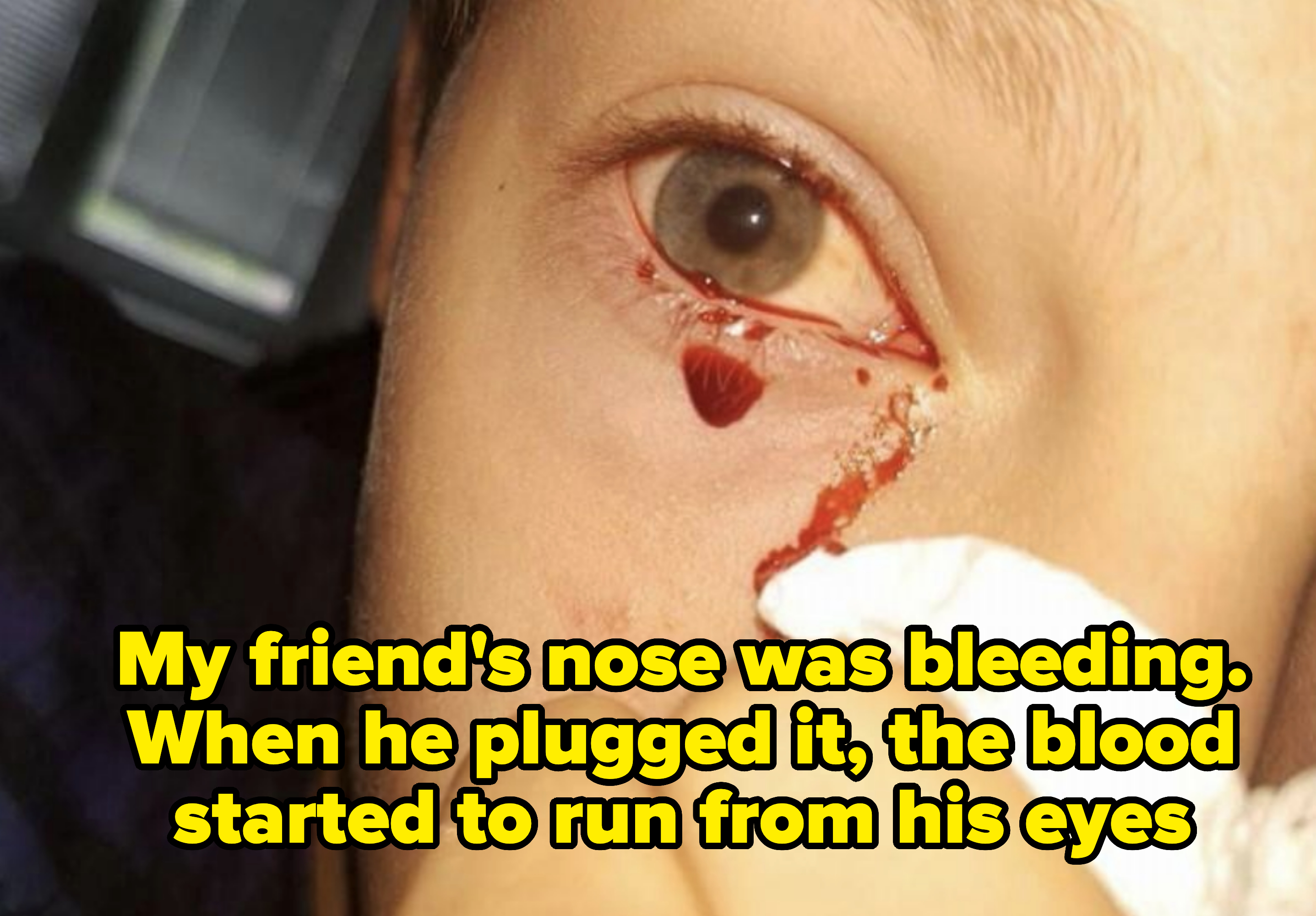 blood trailing out of an eye