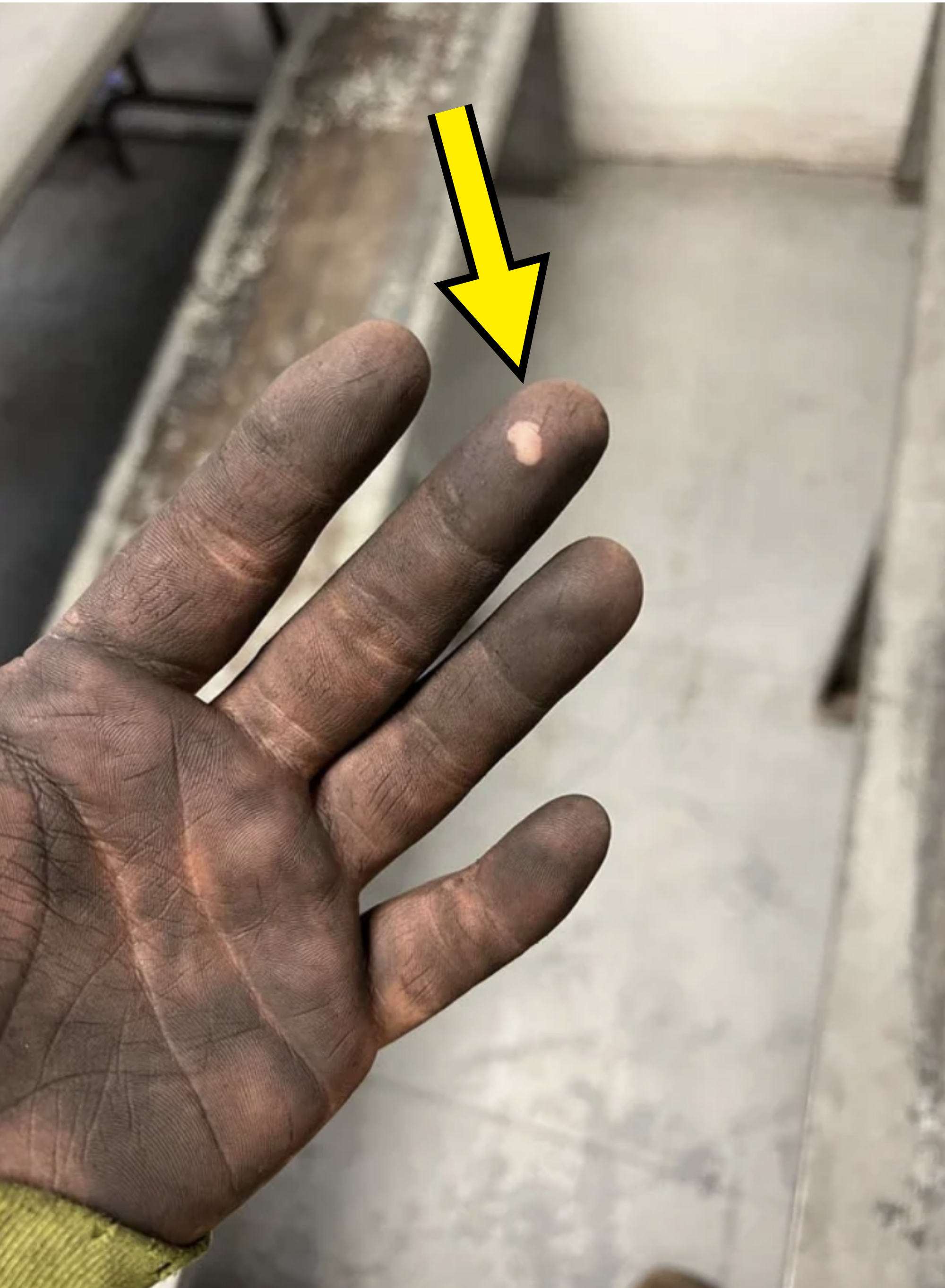 dirty hand with small spot that&#x27;s not dirty