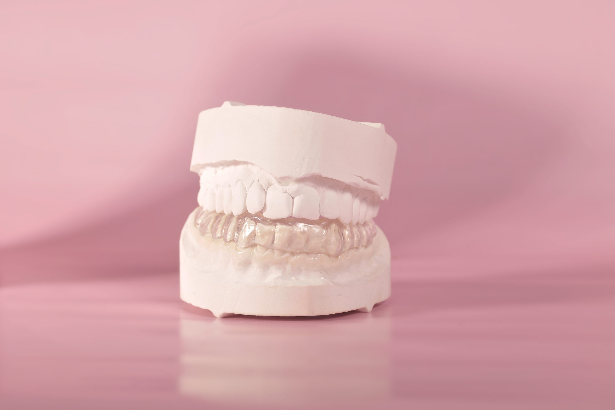 A dental mold of upper and lower teeth set against a pink backdrop