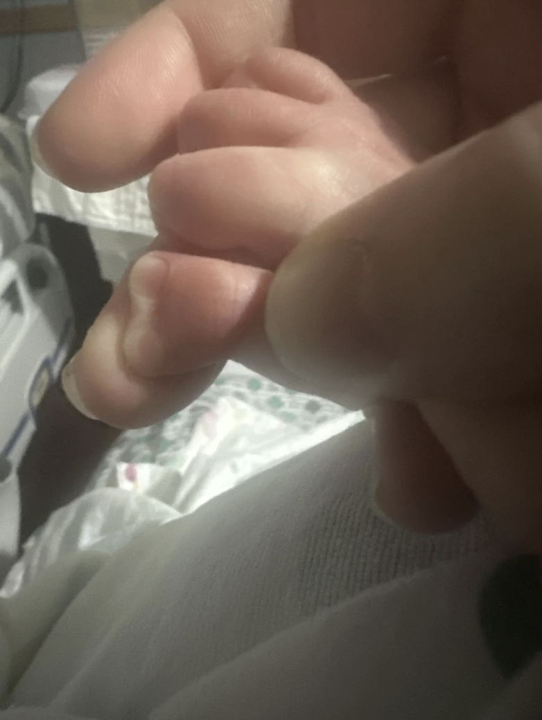 Close-up of an adult&#x27;s hand gently holding a newborn baby&#x27;s tiny hand, with what looks like two fused fingers with the nailbeds resembling a heart
