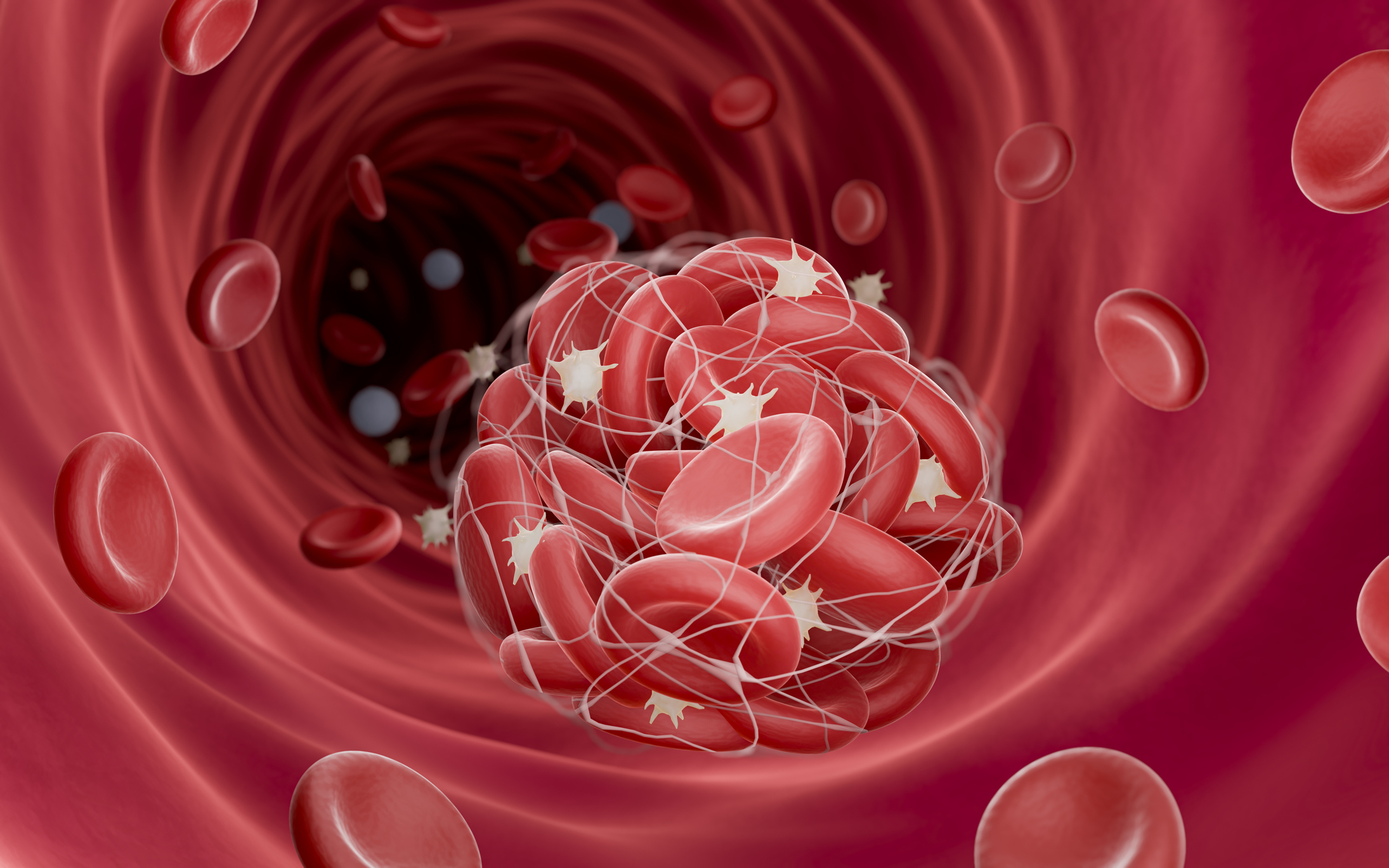 Digital illustration of a blood clot inside a blood vessel with red blood cells