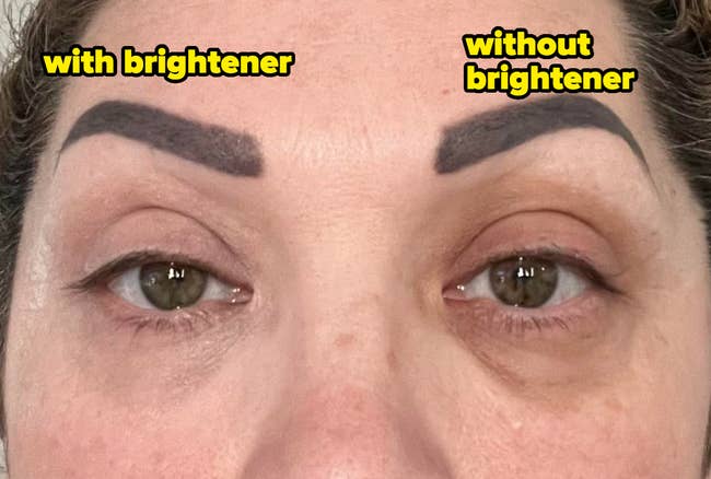 Close-up of a reviewer with eye brightener on their left eye and without it on the right 