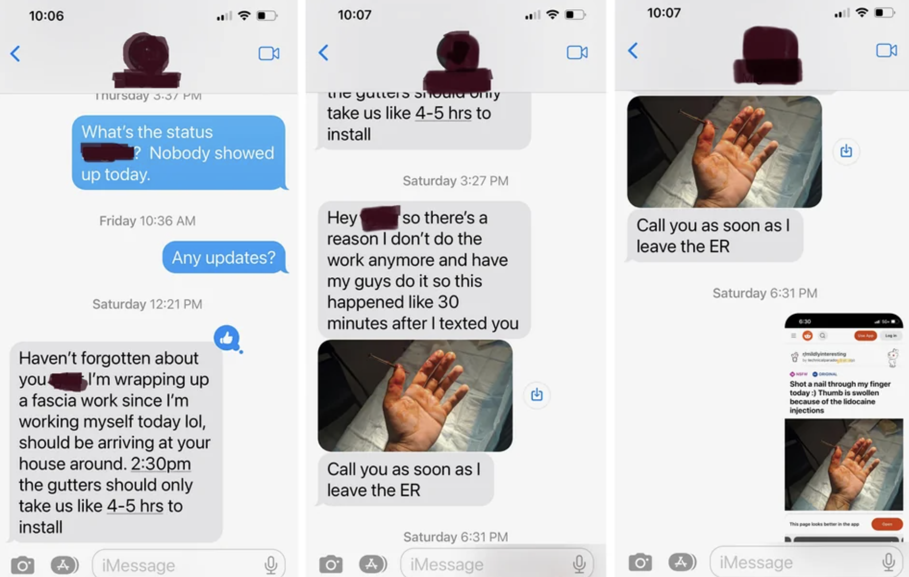 Text message exchange showing someone&#x27;s hand injured, asking to take the day off work for recovery