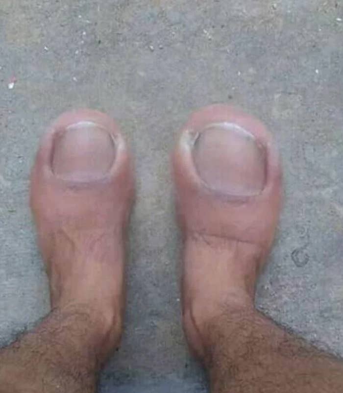A person&#x27;s feet photoshopped to look like large toes