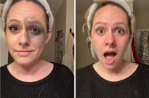 Woman comparing skincare treatment, one side before and other after, looking surprised