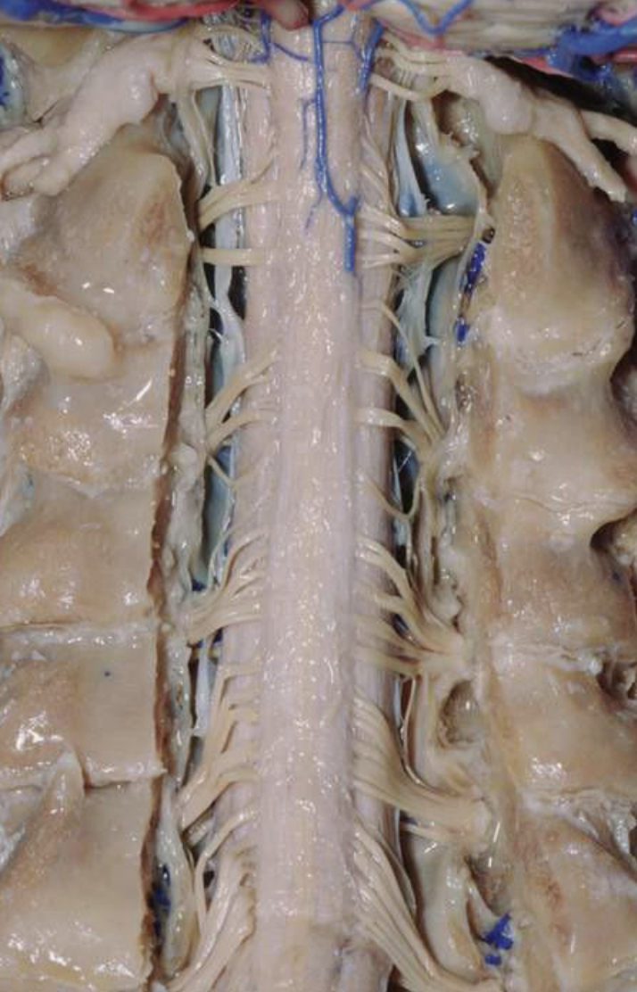 Human cadaver dissected to show the central nervous system and branching peripheral nerves