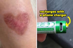 Heart-shaped bruise on skin; battery with humorous text implying it recharges via phone charger