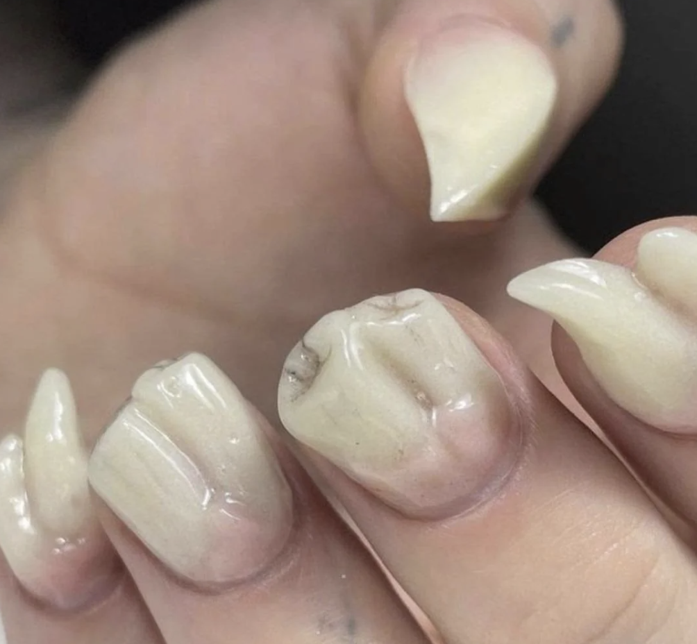 Nails shaped like teeth