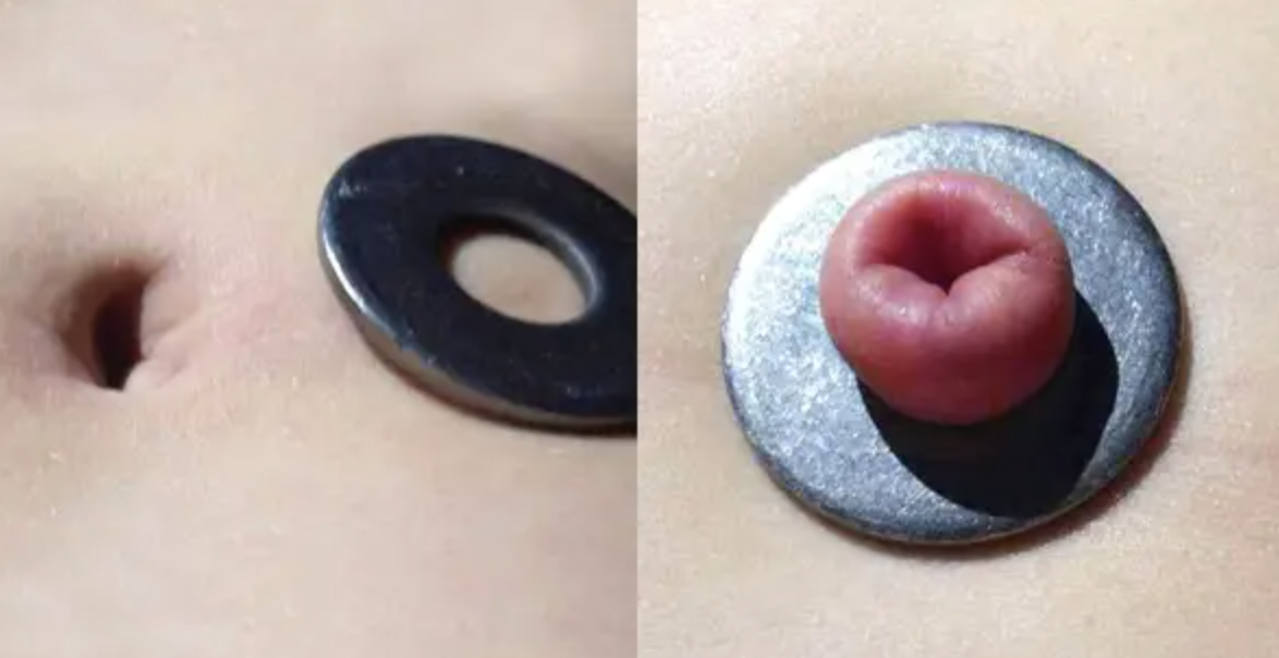 A belly button pushed through a washer