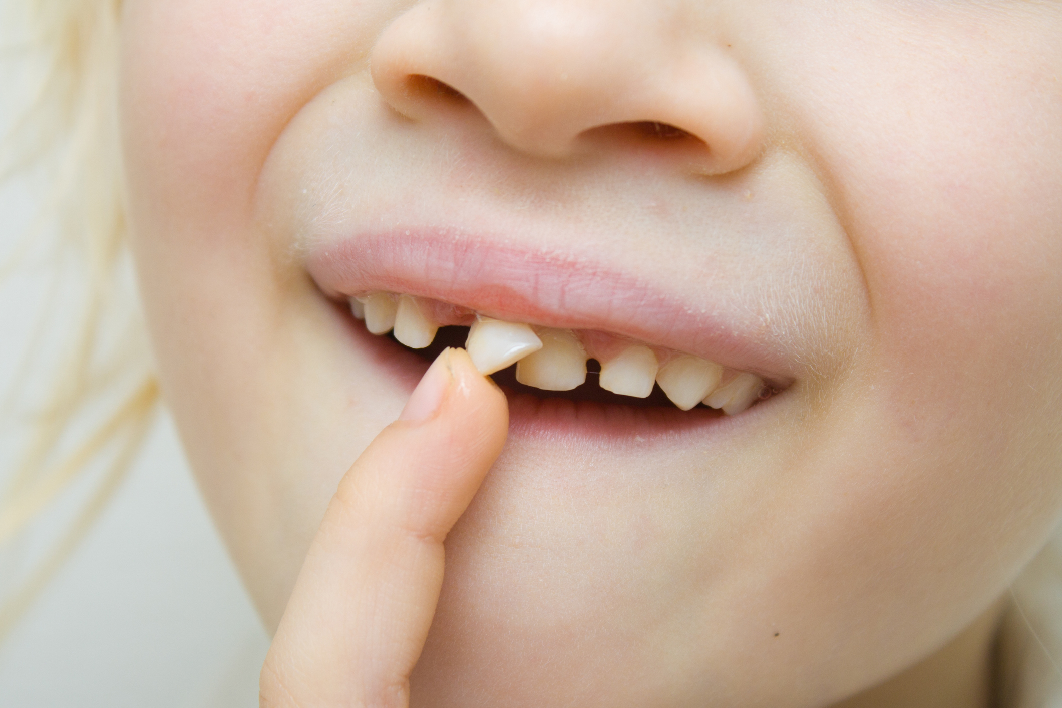 Child pointing to a lost tooth in their smile