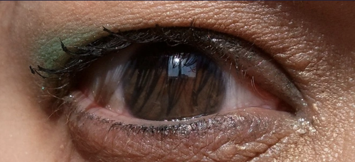 Close-up of a person&#x27;s eye with no pupil, just iris