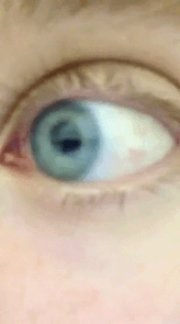 Close-up of a person&#x27;s eye blinking rapidly and looking from side to side