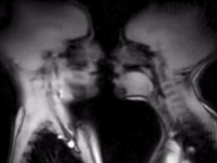 Blurred MRI image of two people tongue-kissing