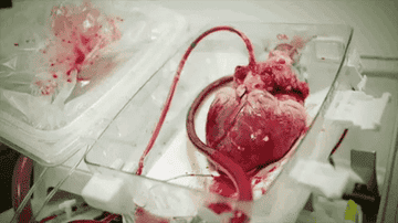 A beating heart connected to medical equipment in a clear tray