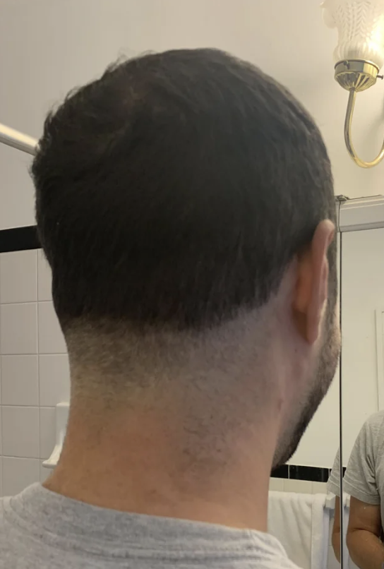 Man with a short haircut viewed from the side, with a mirror partially reflecting his face