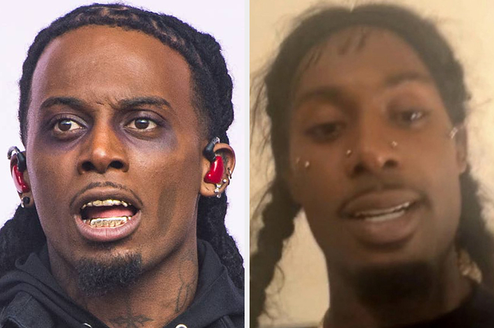 Rich the Kid in two side-by-side portraits, showing his hairstyle and grills