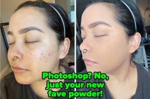 a reviewer with acne on their cheek and after looking like it's completely gone "Photoshop? No, just your new fave powder"