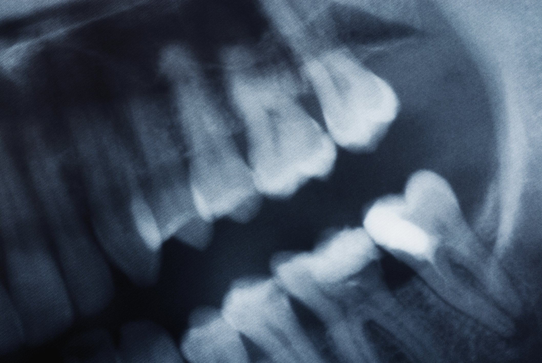 Dental X-ray showing a close-up of human teeth, commonly shared as an intriguing internet find