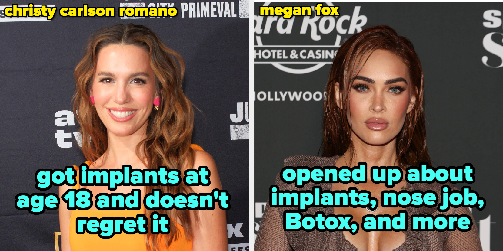 Megan Fox Details Plastic Surgeries Including Multiple Breast