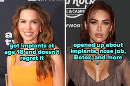 Celebrities discussing their implants, nose job, and Botox