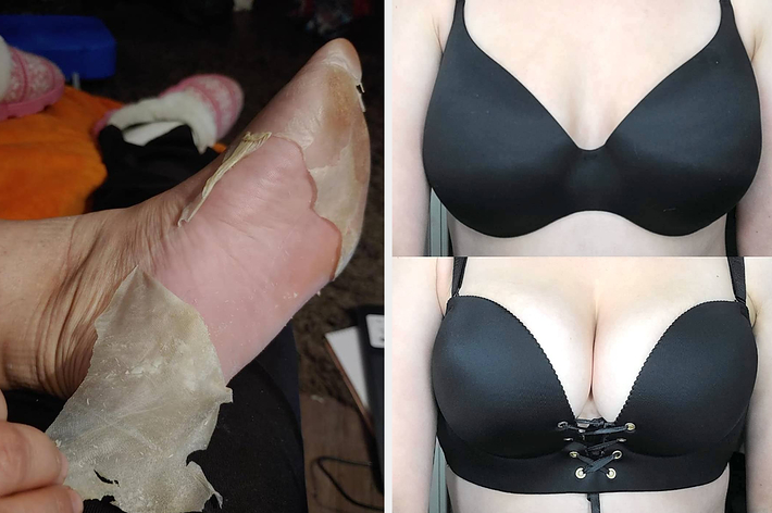 reviewer peeling skin off foot and reviewer wearing push up lace up bra