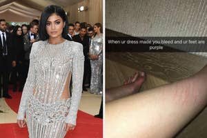 Kylie Jenner in a sparkly dress, her Snapchat showing the aftermath of how it made her bleed and her feet are purple