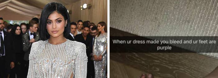 Kylie Jenner in a sparkly dress, her Snapchat showing the aftermath of how it made her bleed and her feet are purple